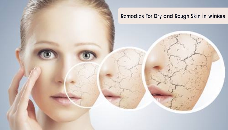 Best remedies for Dry and Rough Skin in winters